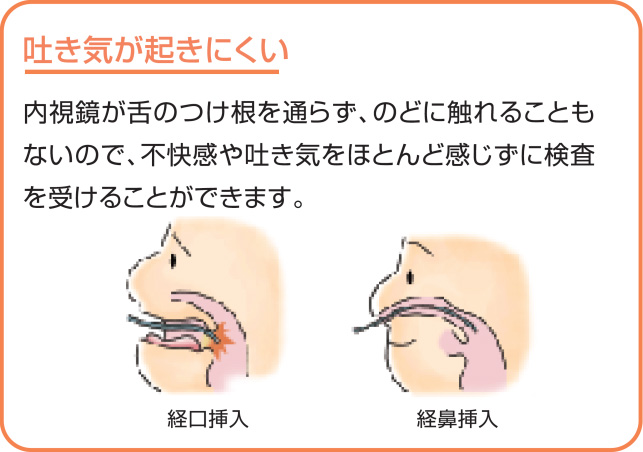 吐き気が起きにくい